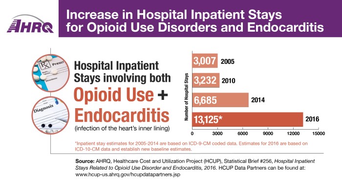 Increase in Hospital Inpatient Stays for Opioid Use Disorders and Endocarditis, 2016. Hospital Inpatient Stays involving both Opioid Use plus Endocarditis (infection of the heart's inner lining): 3007 in 2005, 3232 in 2010, 6685 in 2014, 13,125 in 2016.
