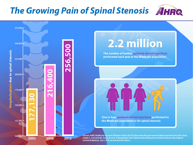 The Growing Pain of Spinal Stenosis. Chart 1: Hospitalizations due to spinal stenosis (Bar graph): 2003 (177,130), 2008 (216,400), 2012 (256,500).Chart 2: 2.2 million lumbar epidural steroid injections are performed each year in the Medicare population.Chart 3: One in four epidural steroid injections performed in the Medicare population is for spinal stenosis.