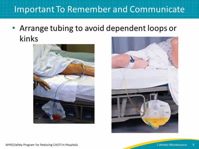Arrange tubing to avoid dependent loops or kinks. Also shown are images of the wrong and right way to place the catheter bag.