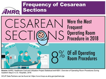 Frequency of Cesarean Sections: Cesarean Sections were the most frequent operating room procedure in 2018, 8 percent of all operating room procedures.