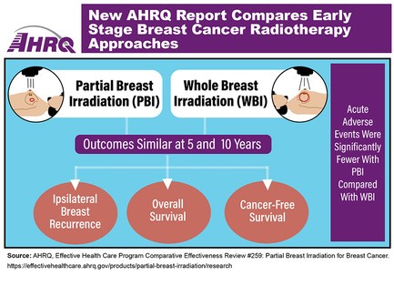 New AHRQ Report Compares Early Stage Breast Cancer. Outcomes of Partial Breast Irradiation and Whole Breast Irradiation are similar at 5 and 10 years: Ipsilateral breast recurrence, overall survival, and cancer-free survival. Acute adverse events were significantly fewer with Partial Breast Irradiation compared with Whole Breast Irradiation.