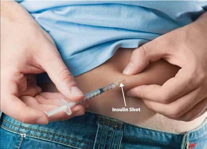 A photo showing patient injecting herself in the abdomen with insulin.