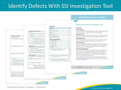 Identify Defects With SSI Investigation Tool