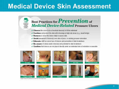 Medical Device Skin Assessment