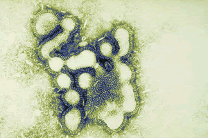 Photo of the Ebola Virus.